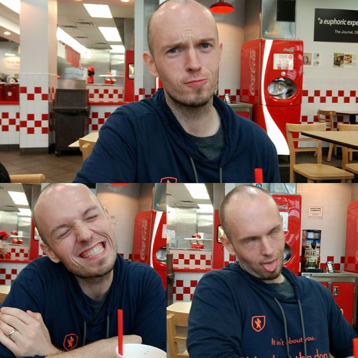 bald boy