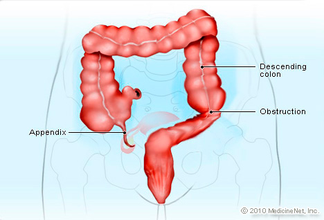 appendix